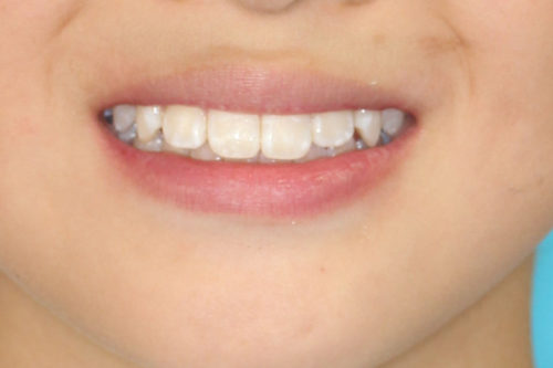 %e7%ac%91%e9%a1%94%e3%80%80%e5%b0%8f%e5%85%90%e7%b5%82%e4%ba%86